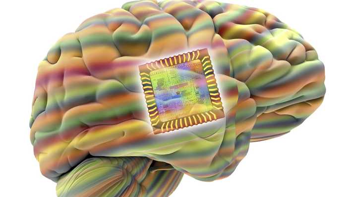 Chip im Gehirn (Bild: imago/Science Photo Library)