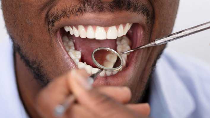 Symbolbild: Zahnarzt untersucht Zähne (Bild: imago images/ Andrey Popov)