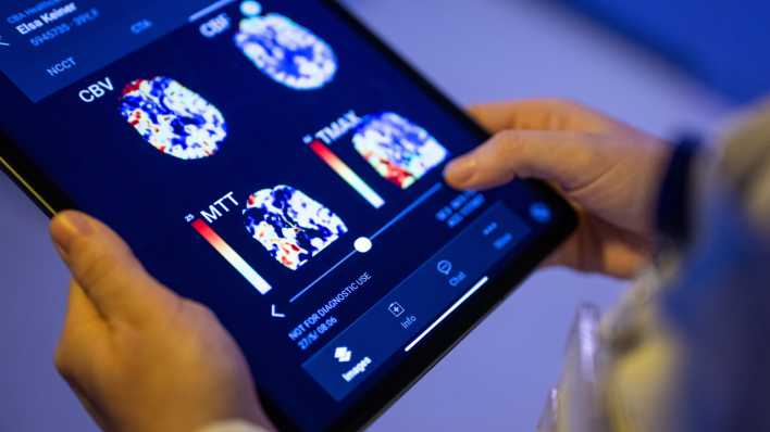 Eine Radiologin im Unfallkrankenhaus Berlin betrachtet in einer KI-basierten App auf einem Tablet Gehirnbilder eines Patienten.
