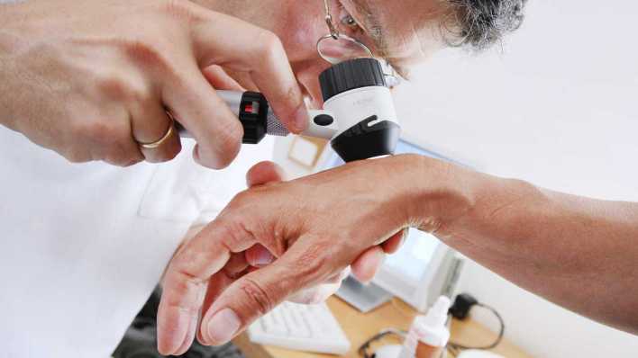 Hautarzt untersucht mit einem Vergrößerungsglas die Haut einer Patientin bei einer Hautkrebs-Früherkennung (Bild: picture alliance/dpa)