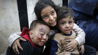 Nahost-Konflikt: Verletzte Kinder in Gaza