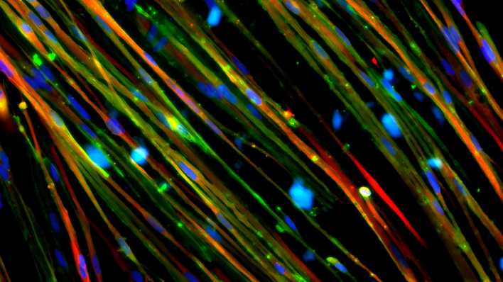 Abbildung von Muskelfasern, die mit der CRISPR-Gen-Schere therapiert wurden. (Bild. picture alliance / BSIP | NIH / IMAGE POINT FR)